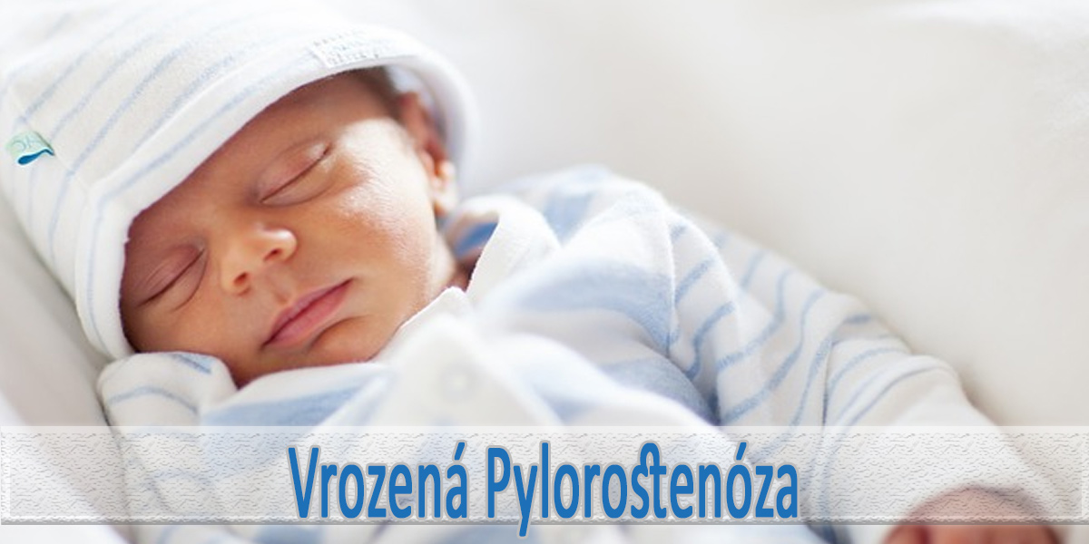Pylorostenoza u novorozence